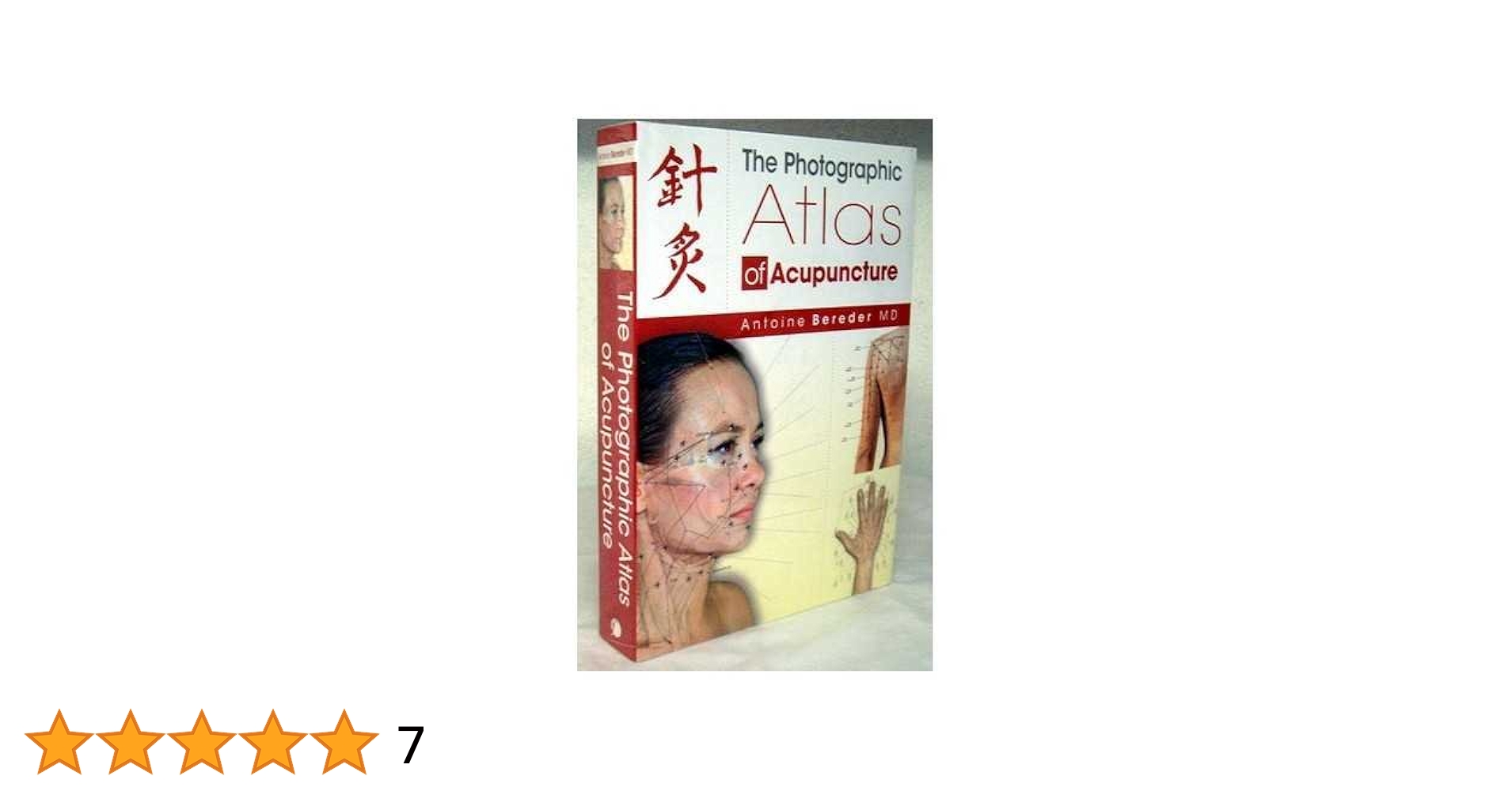 The Photographic Atlas of Acupuncture: 9781844095384